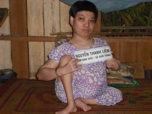 Người khuyết tật xin được giúp đỡ